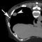 Figure 14a.