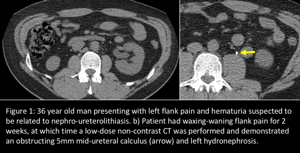 Suspect flank pain? Consider ultrasound for first-line imaging • APPLIED  RADIOLOGY