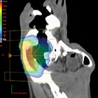 FLASH Stance — Updates in Ultrahigh Dose Rate Radiation Therapy