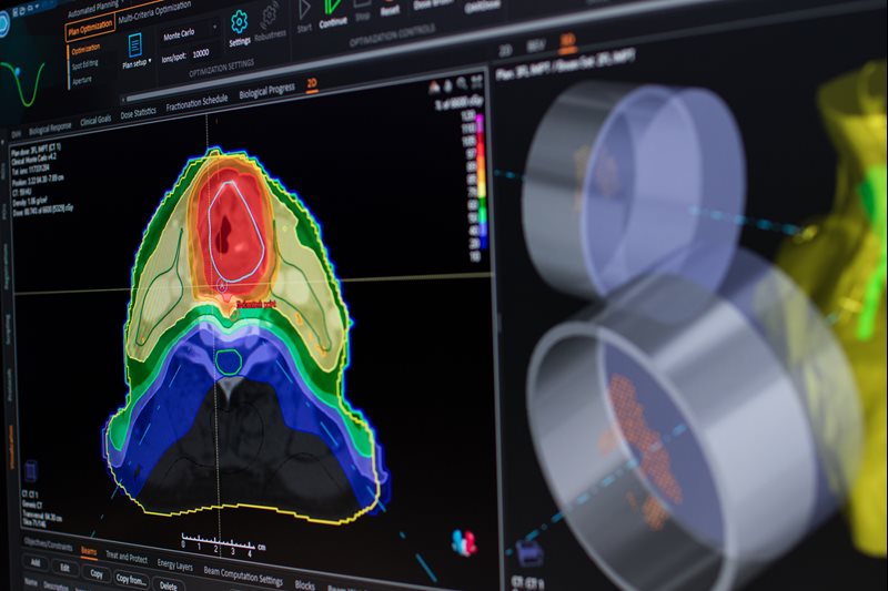 RaySearch Expands Collaboration with P-Cure for Proton Therapy