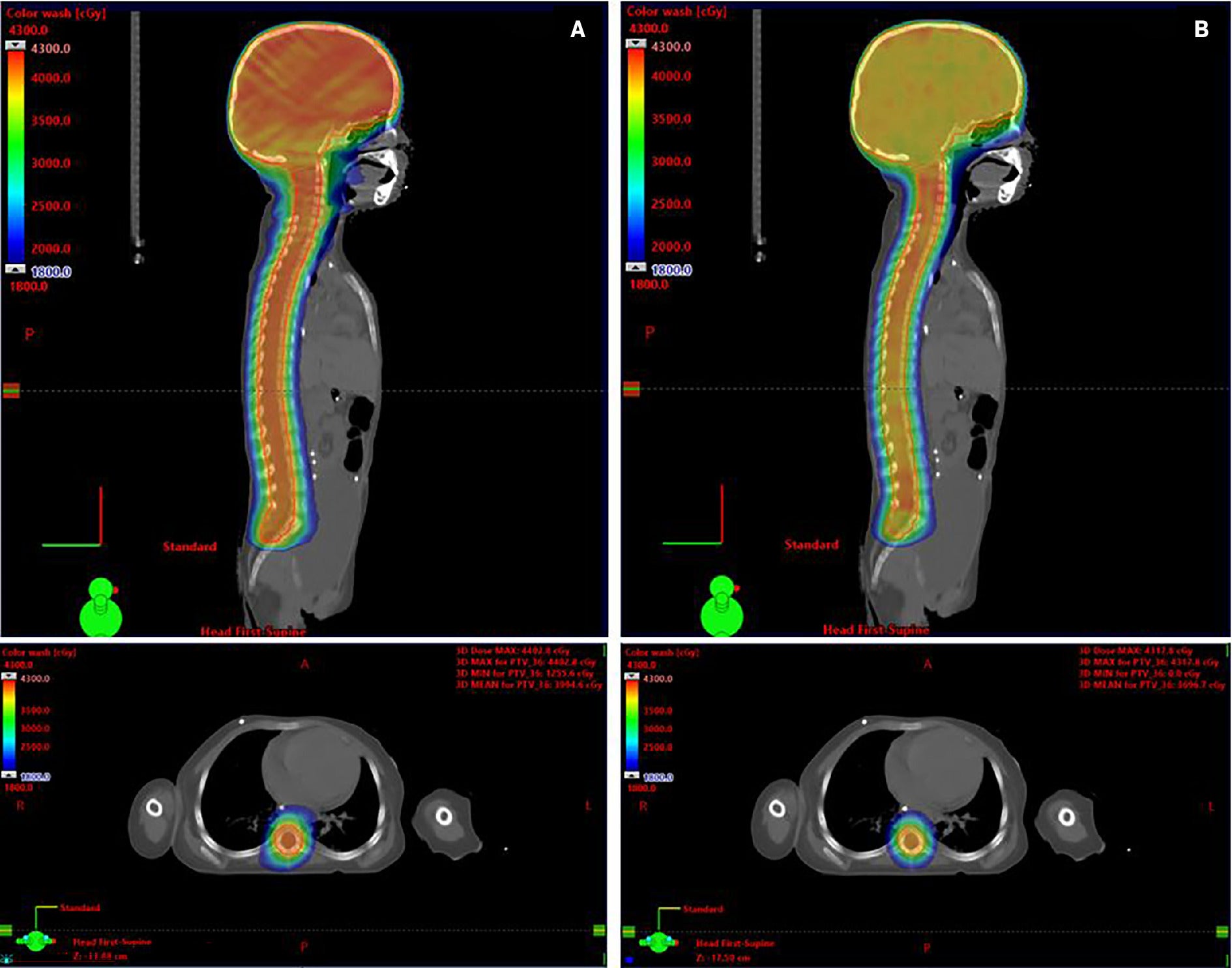 https://cdn.agilitycms.com/applied-radiation-oncology/publishhub/ARO-14-1-00032/ARO-14-1-00032-F001.jpeg