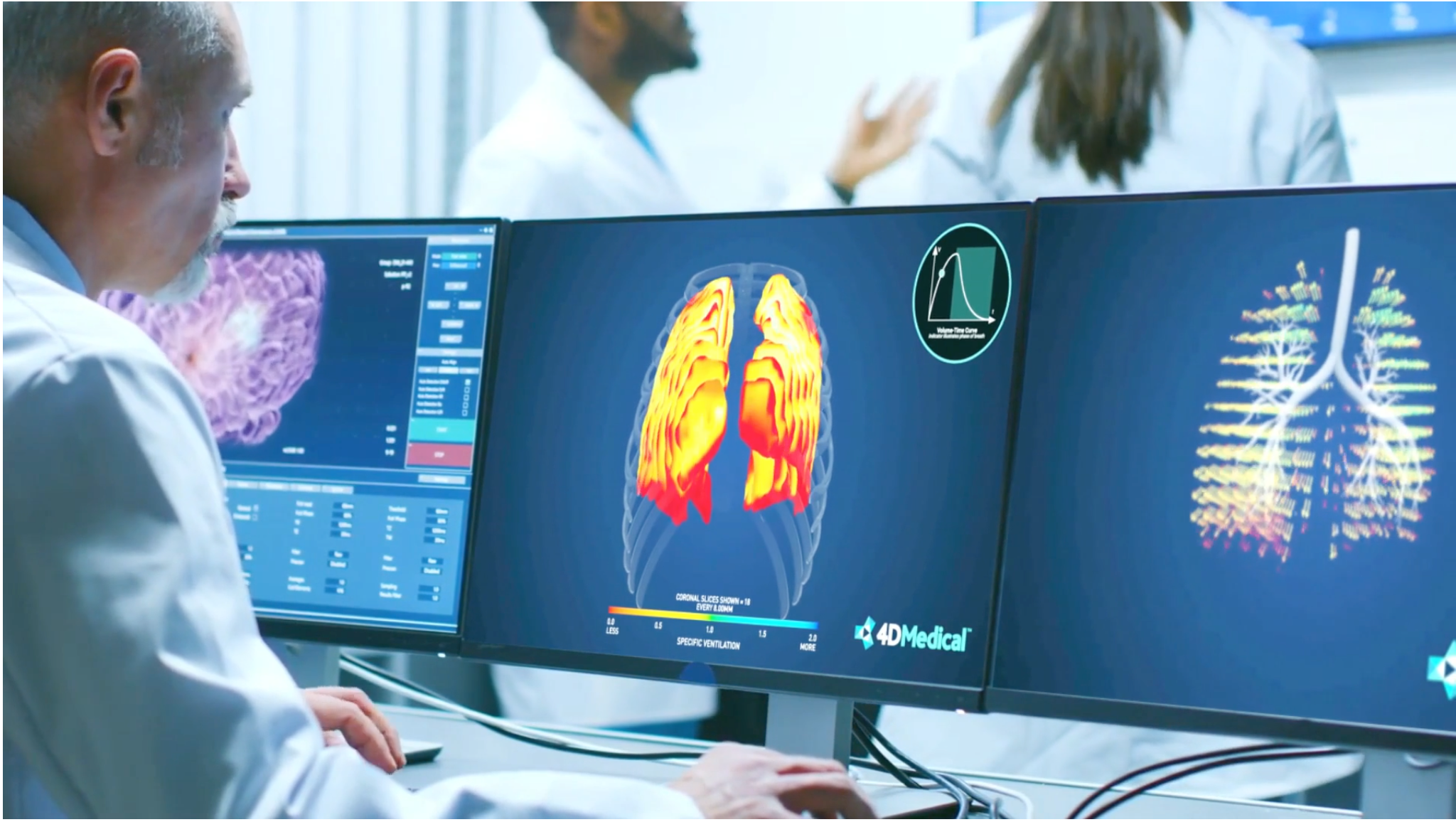 Azra AI and 4DMedical Partner to Automate Lung Health Care Pathways