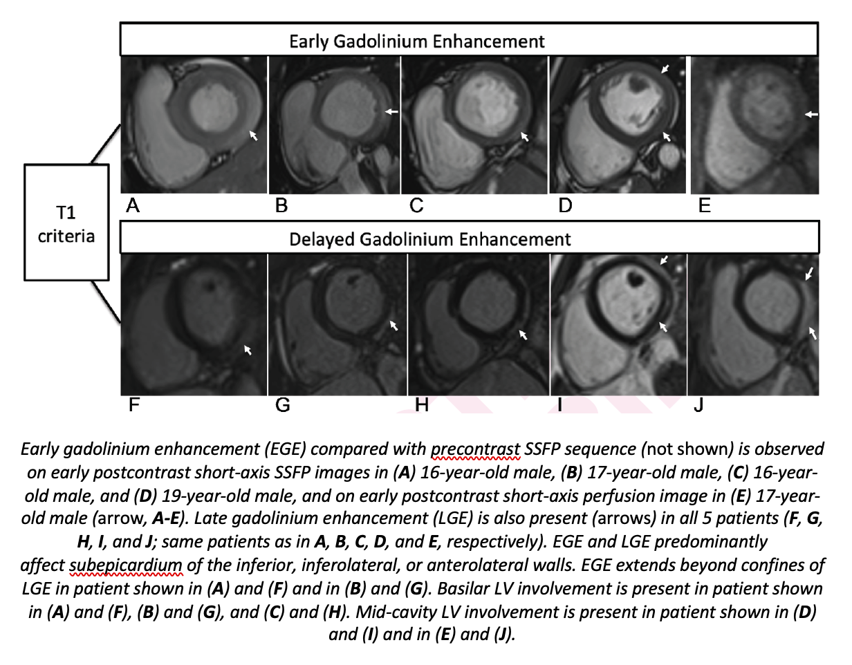 Cardiac MRI of Myocarditis in Adolescents after COVID-19 Vaccine ...