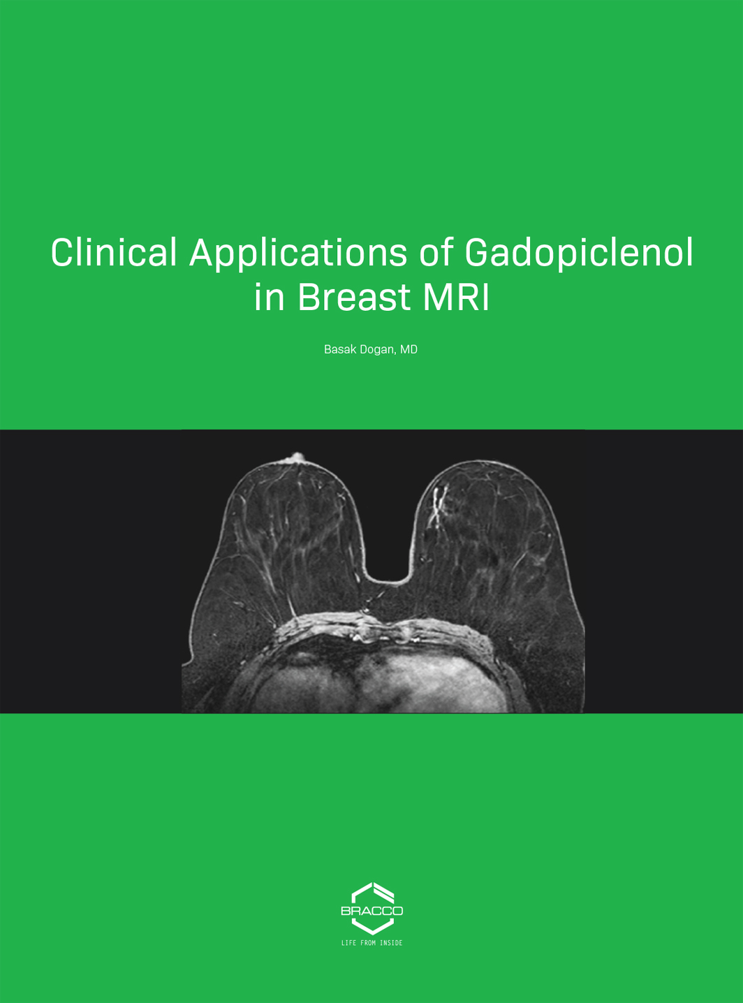 clinical applications of gadopiclenol in breast mri