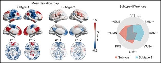 Type 2 Diabetes May Change Brain Structure | Applied Radiology