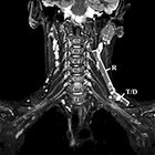 Imaging brachial plexus pathology