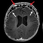 Epilepsy imaging: Approaches and protocols
