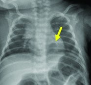 September 2023 Applied Radiology September 2023 Applied Radiology