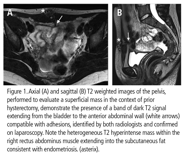 Pelvic Magnetic Resonance Imaging An Overview ScienceDirect, 59% OFF