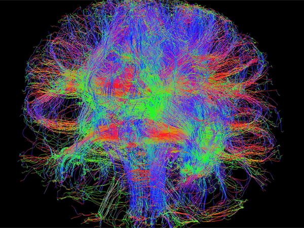 Advanced Brain Imaging Study Examines How DMT Alters Brain Function ...