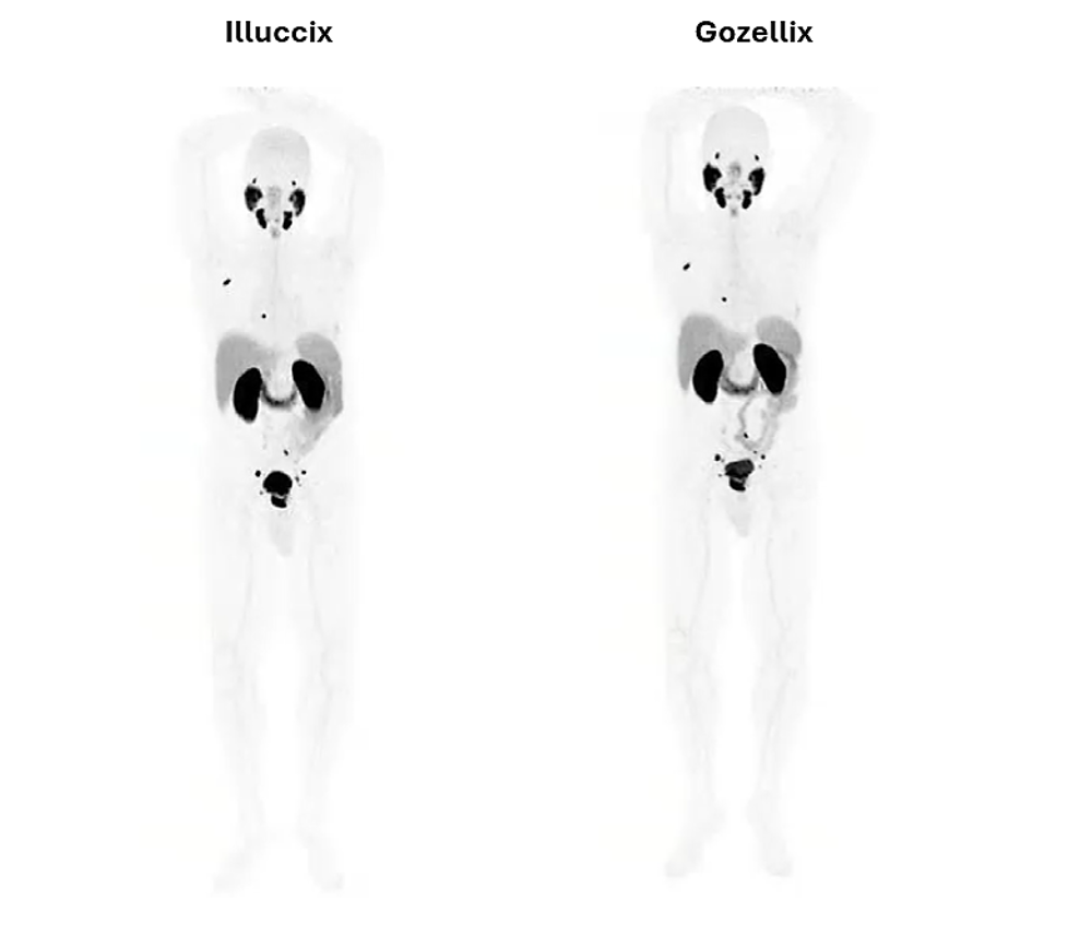 Leveraging Illuccix s Established Imaging Performance An leveraging-illuccix-s-established-imaging-performance-an