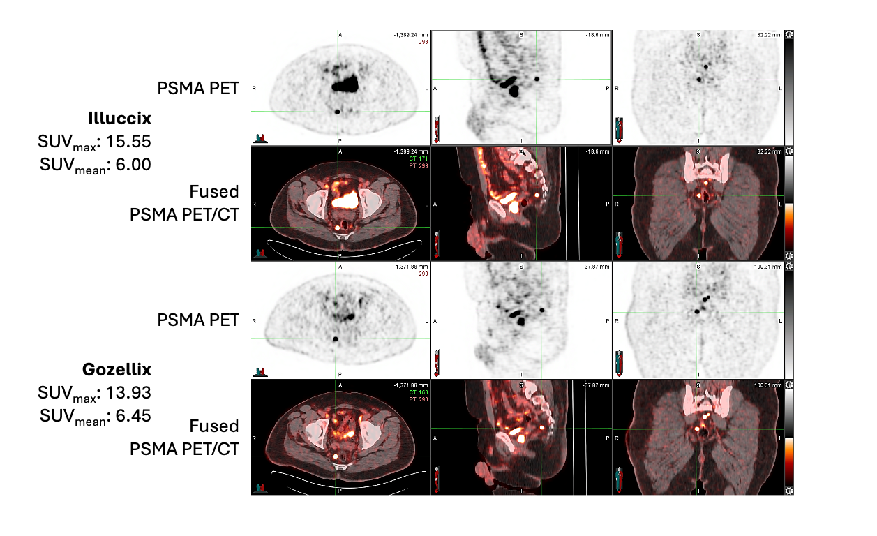 Leveraging Illuccix’s® Established Imaging Performance: An ...
