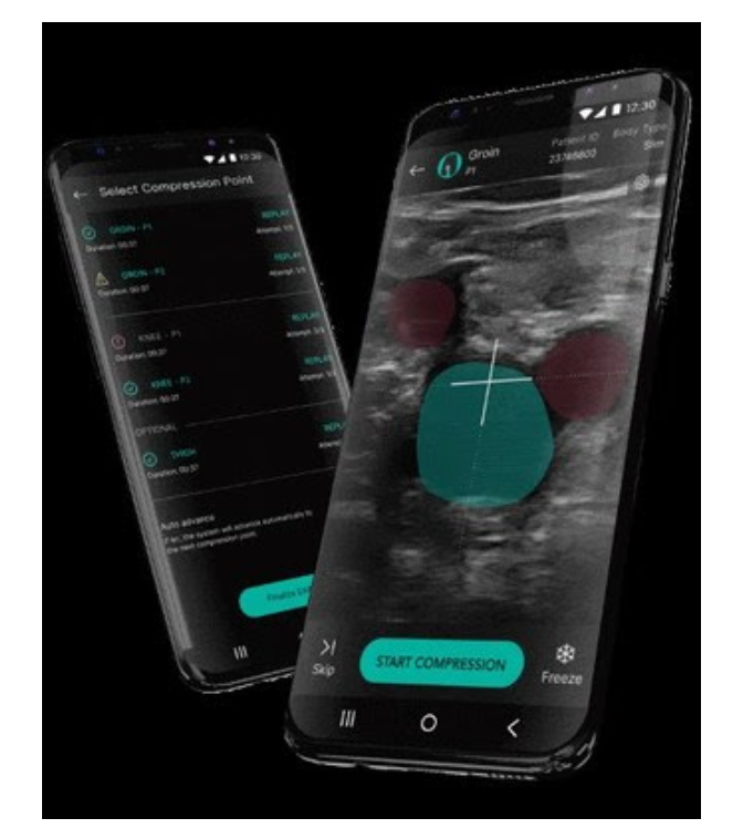 Dvt Intellect AI Algorithm Shows Promise in Diagnosing DVT | Applied Radiology