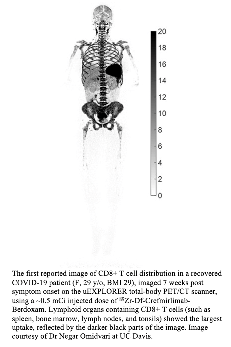 Total-Body PET Assesses Immunological Response to COVID-19 • APPLIED  RADIOLOGY