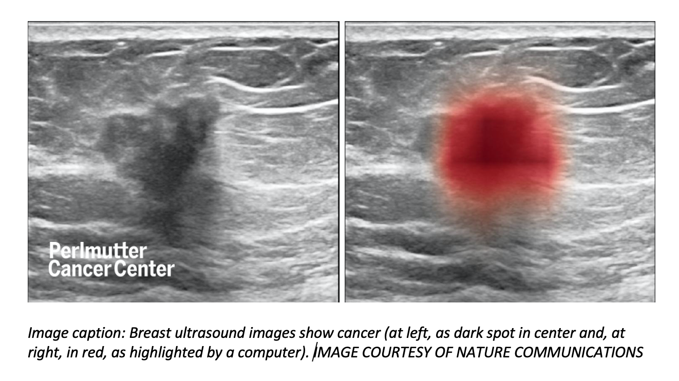 Breast Ultrasound