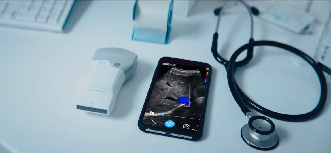 Wireless Ultrasound Probe Increases Imaging Accessibility - Ultrasound -  mobile.