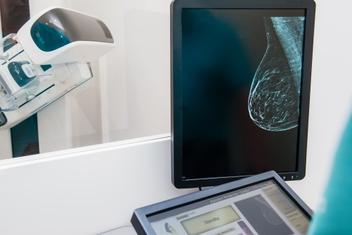 Diagnostic Digital Mammography