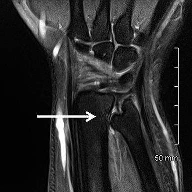 MRI of the wrist • APPLIED RADIOLOGY