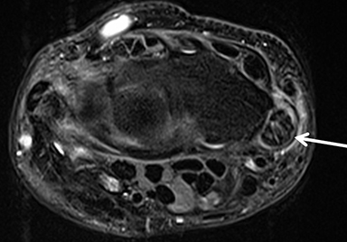 MRI of the wrist • APPLIED RADIOLOGY