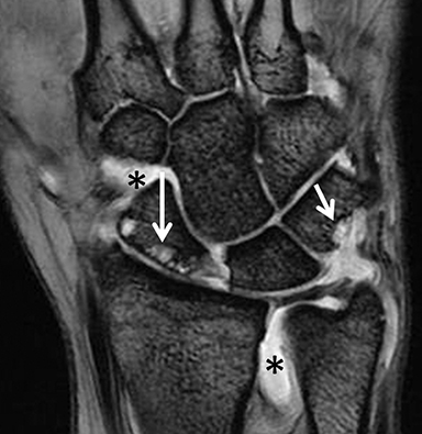 MRI of the wrist • APPLIED RADIOLOGY