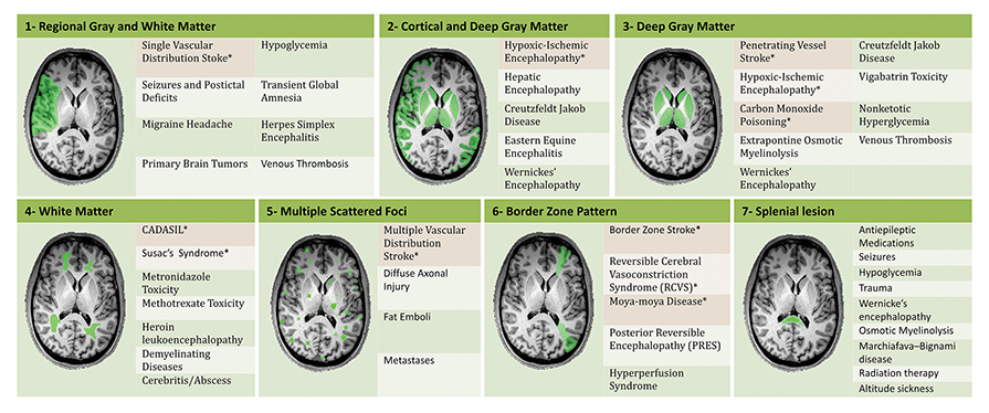 7 Common Stroke Mimics That Look Like You're Having a Stroke