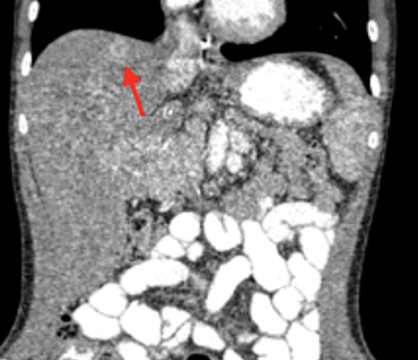 Intravenous Contrast Medium Administration and Scan Timing at CT