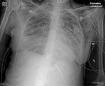 Digital X-Ray and PACS (2005) • APPLIED RADIOLOGY