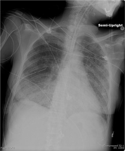 Digital X-Ray and PACS (2005) • APPLIED RADIOLOGY