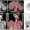 Practical issues in abdominal PET/CT
