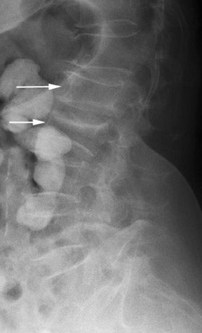 Perfusion CT in the assessment of cerebrovascular disease • APPLIED ...