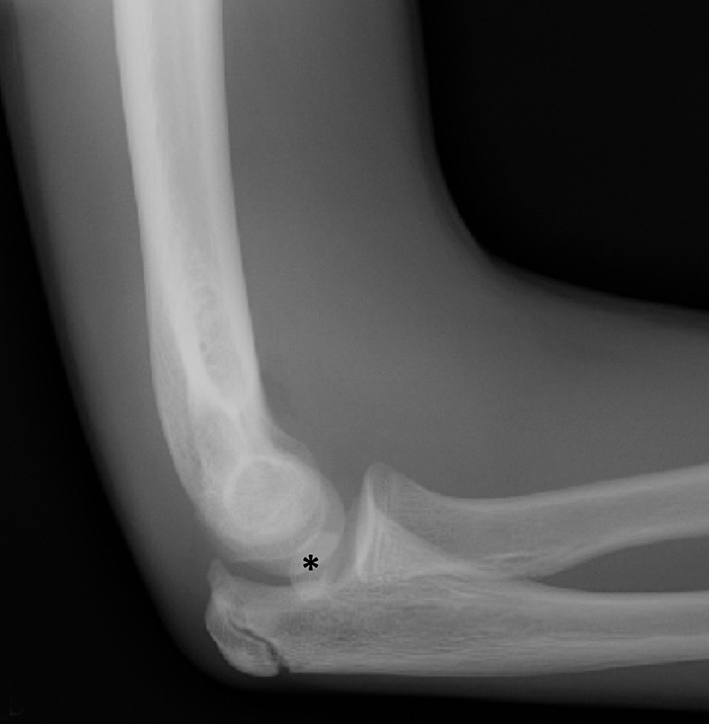 Normal foot x-ray - 2-year-old, Radiology Case