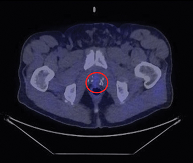 SubtlePET 2.0 Gets CE Mark • APPLIED RADIOLOGY