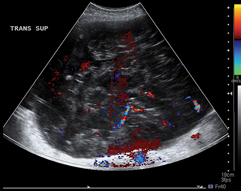 Suspect flank pain? Consider ultrasound for first-line imaging • APPLIED  RADIOLOGY