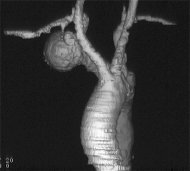 EMI Scanner Mark 1 - The First CT, Sir Godfrey Hounsfield i…