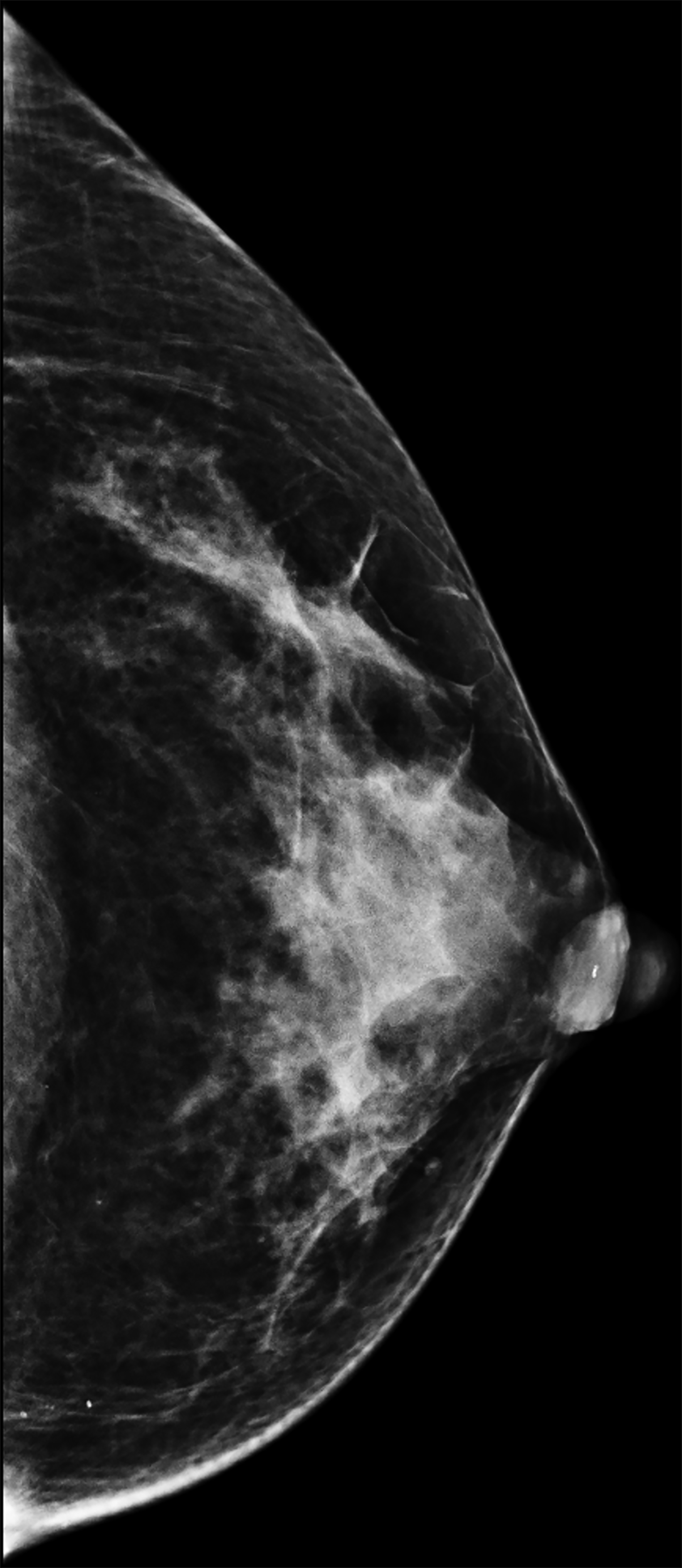 Effects of Gender-affirming Medical and Surgical Therapy on Breast Imaging  Findings and Breast Cancer Risk • APPLIED RADIOLOGY