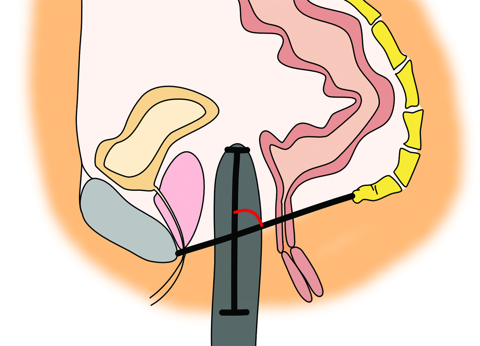 PDF) Differences in Chest Measurements between the Cis-female and Trans-female  Chest Exposed to Estrogen and Its Implications for Breast Augmentation