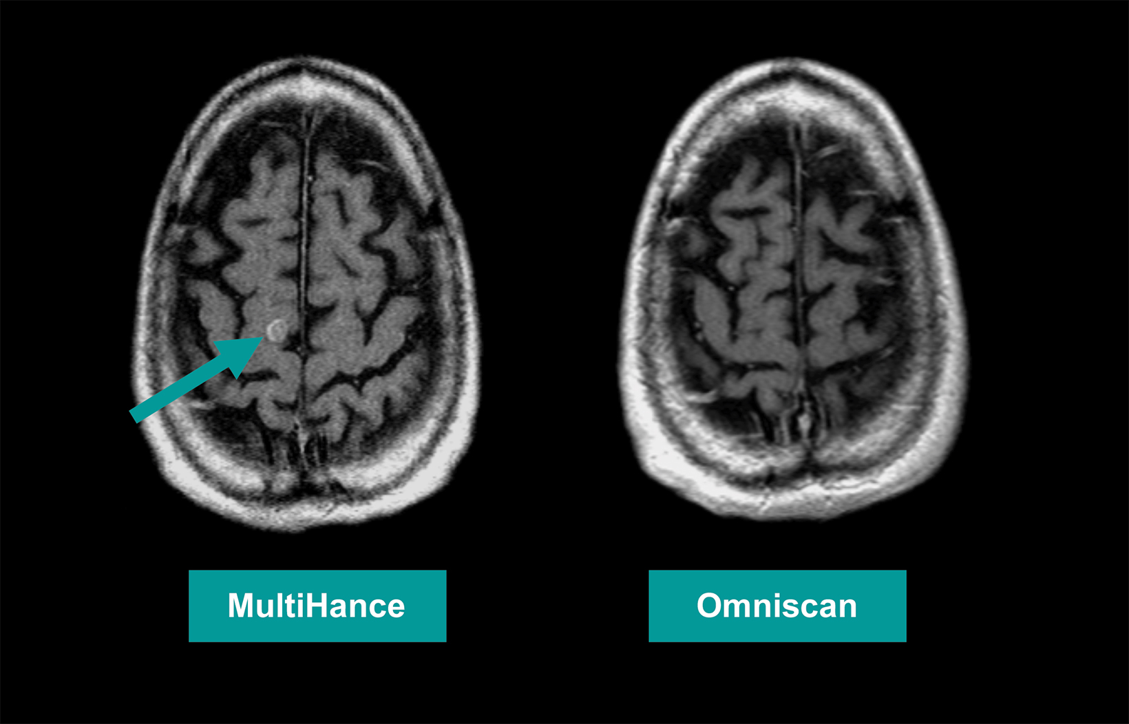 Contrast Radiology