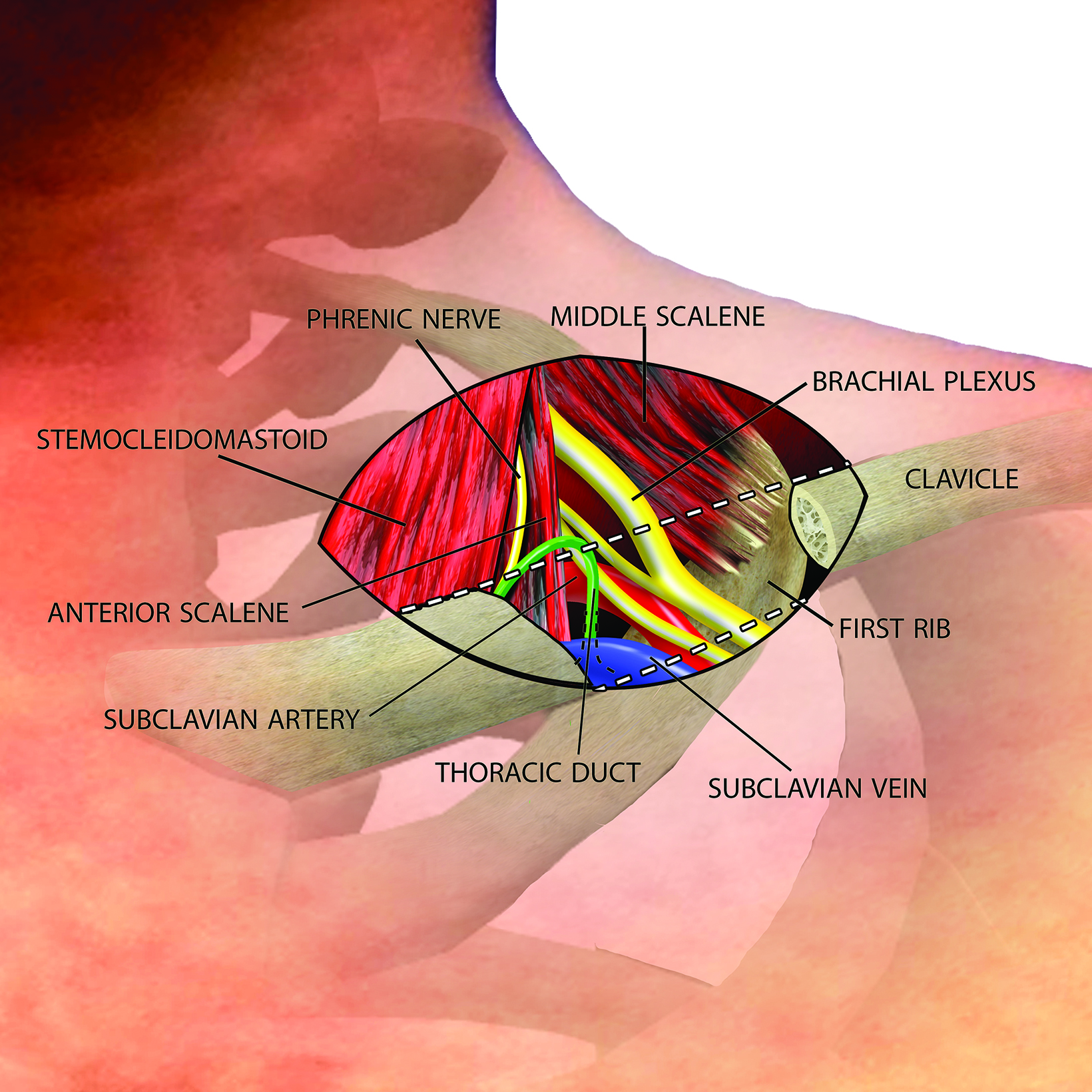 Prehab®️ on X: Pain with Thoracic Outlet Syndrome (TOS) presents