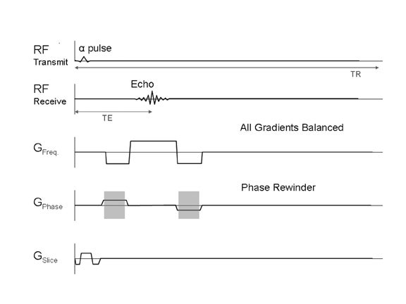 MRI Sequences: balanced gradient echo