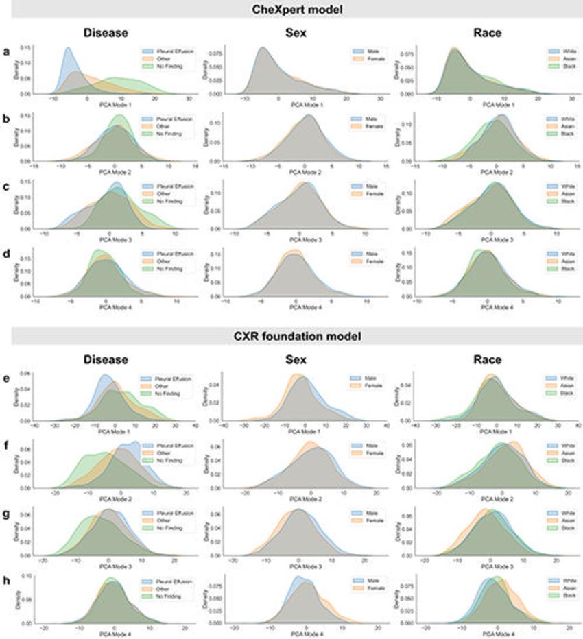 AI Model for Chest X-Ray Demonstrates Race, Sex Bias • APPLIED RADIOLOGY