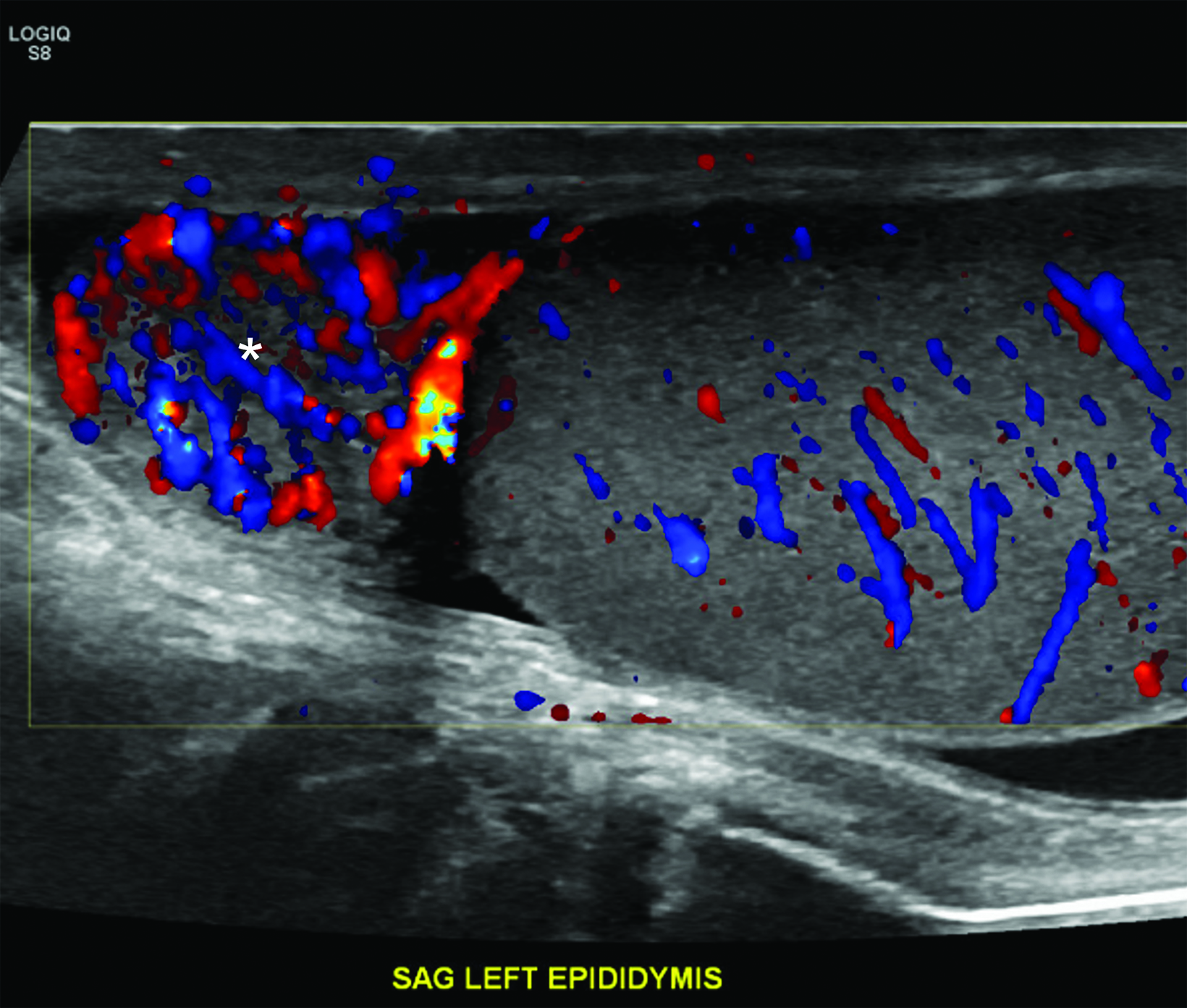 Imaging Testicular Torsion • Applied Radiology 