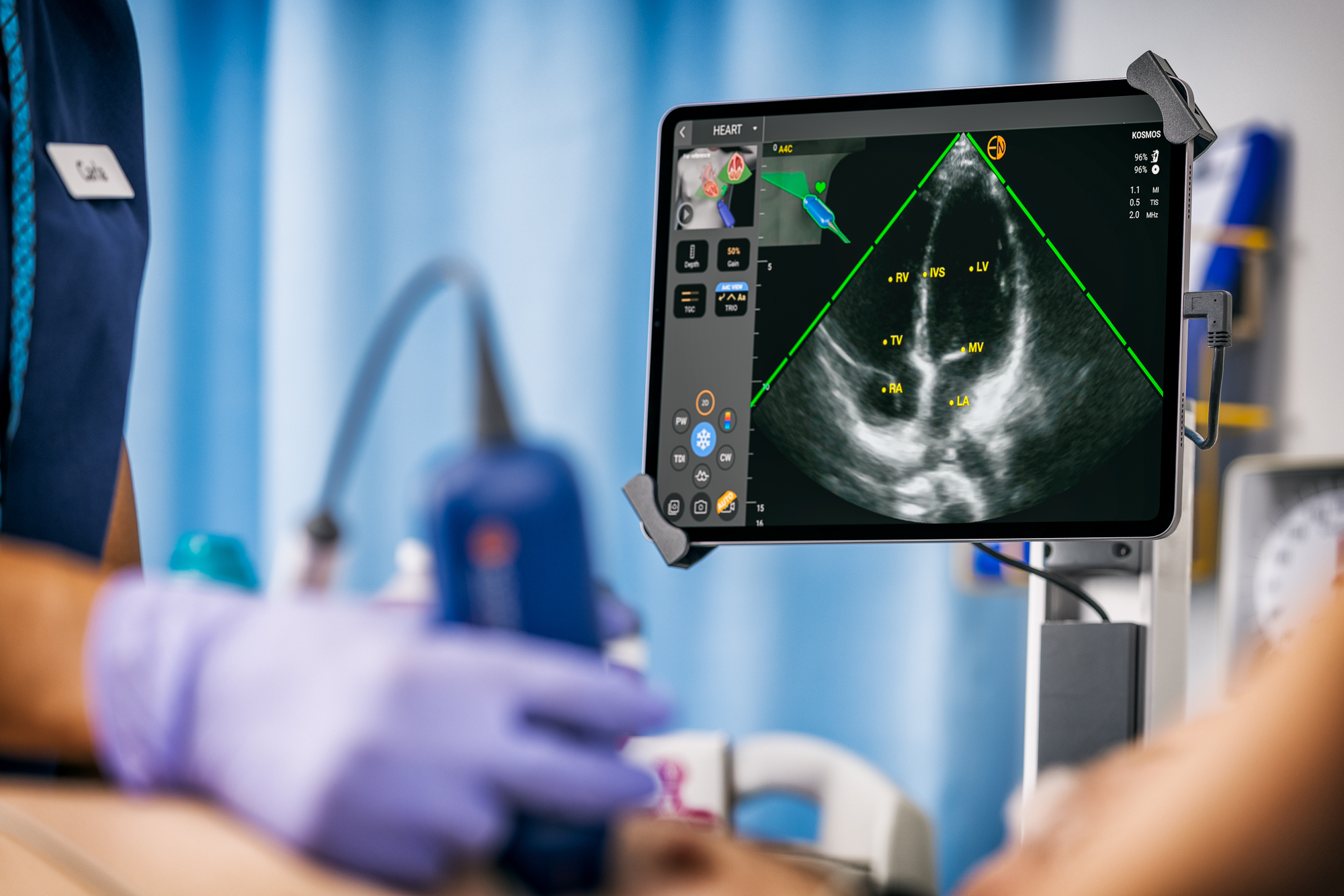 EchoNous Launches Low-Cost POCUS • APPLIED RADIOLOGY