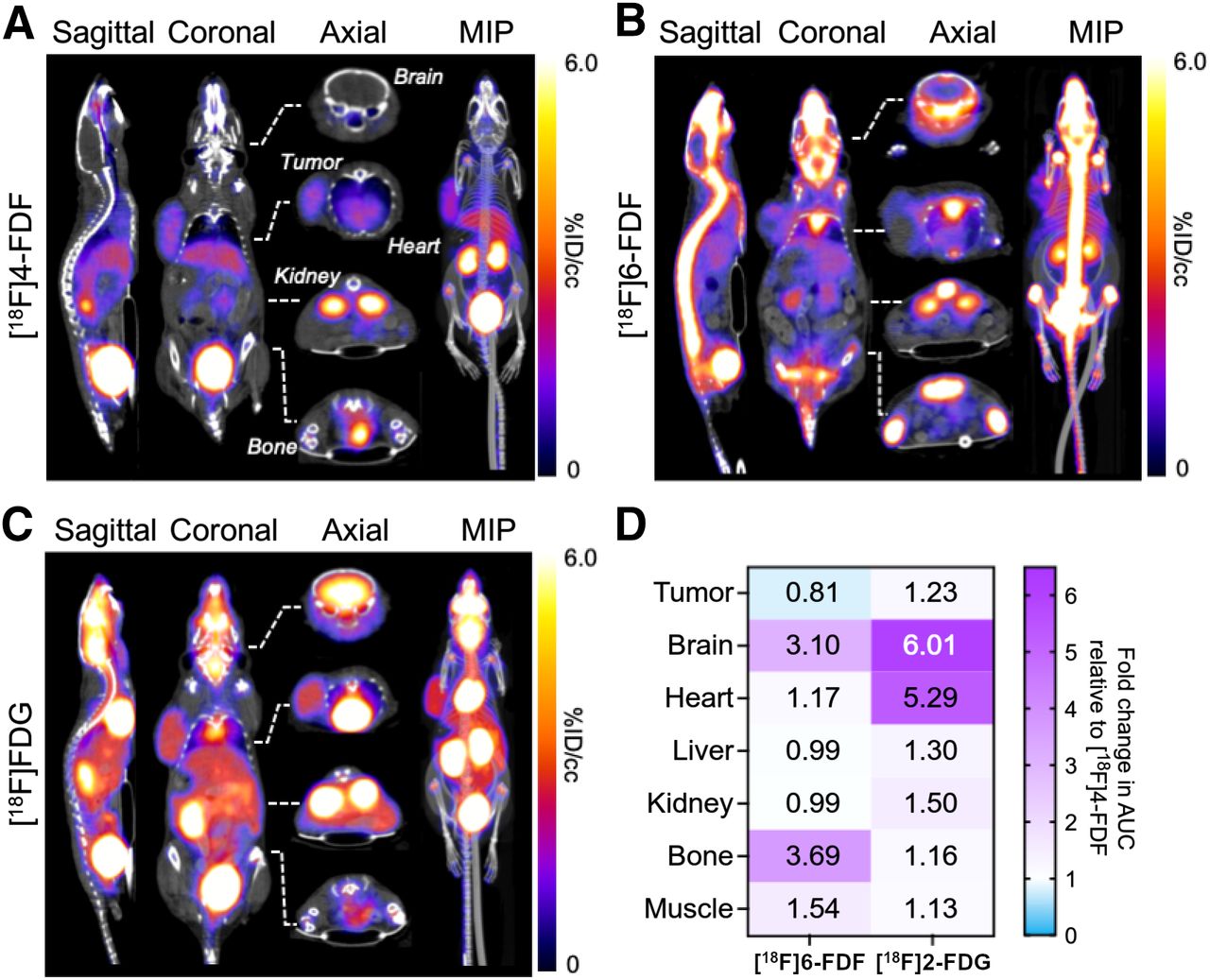 New PET Radiotracer Maps Fructose Metabolism to Detect Diseases ...