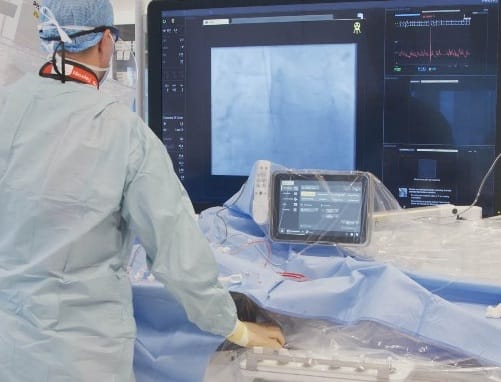 Philips Secures FDA Clearance for AI-Enhanced Ultrasound Systems ...