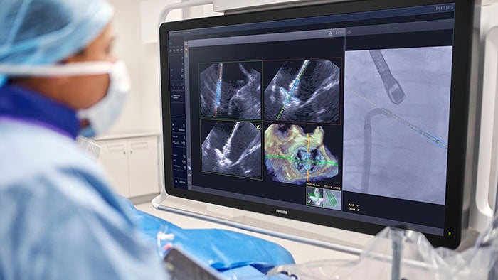 Verida Ct Philips' Verida Spectral CT Receives FDA Clearance | Applied Radiology