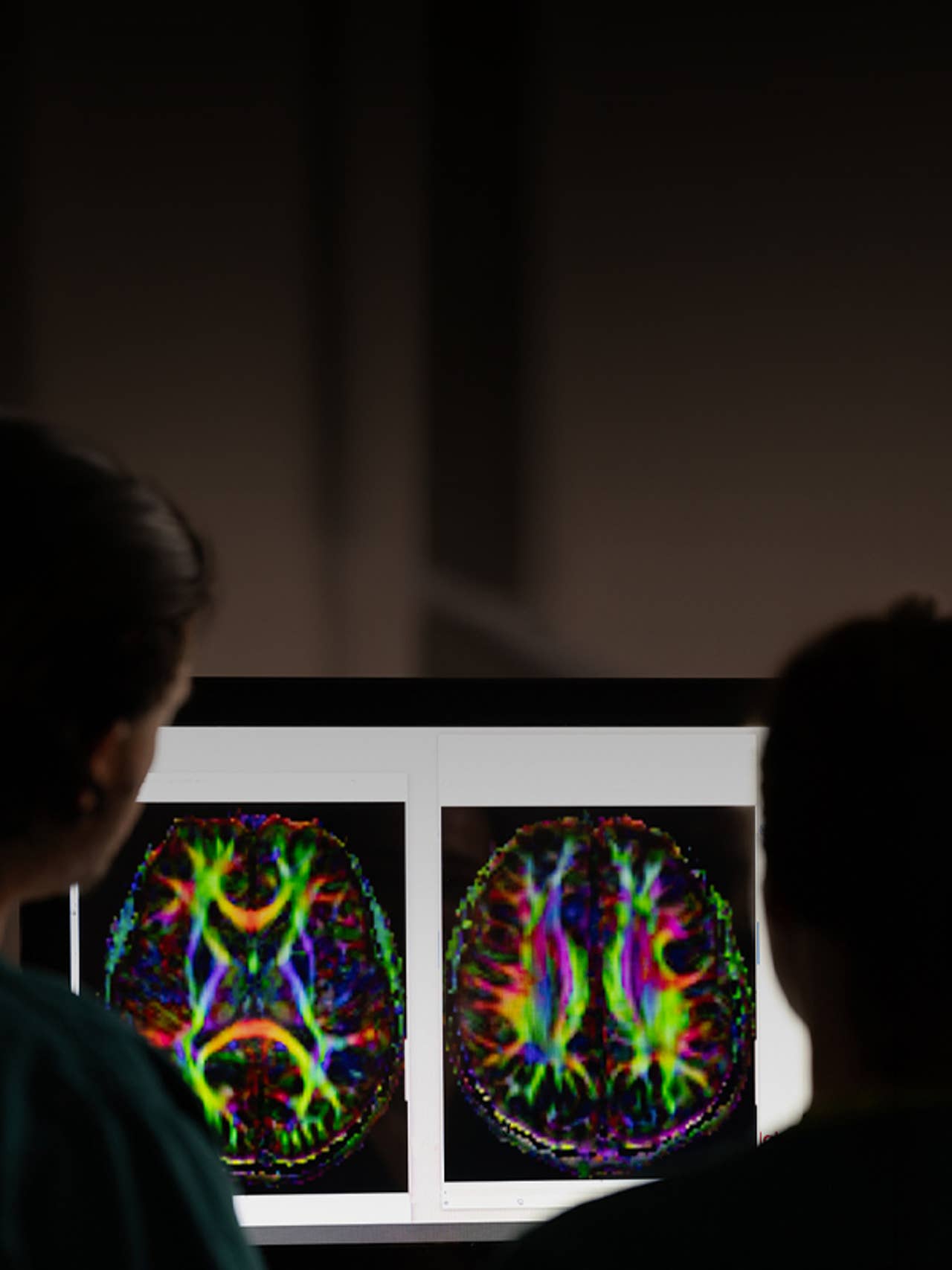 neurology image on a screen